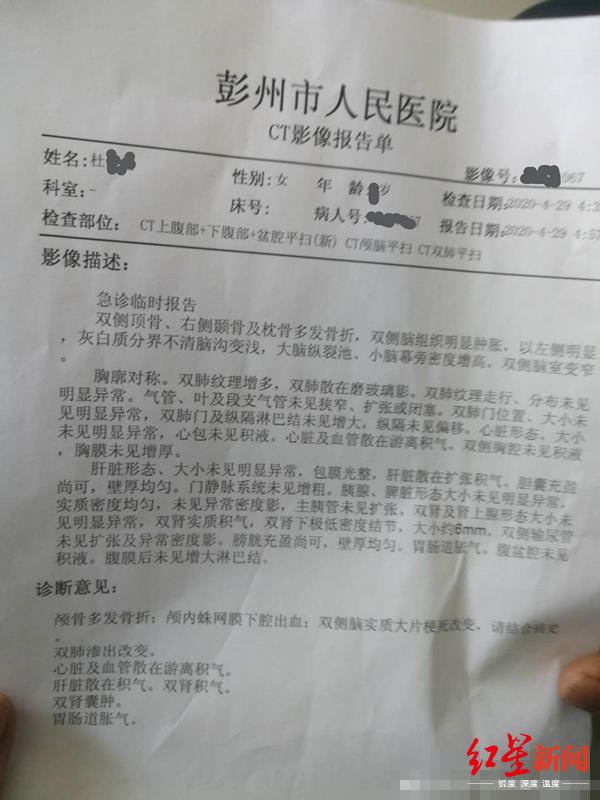 ↑杜某浩被送往急诊后的CT报告