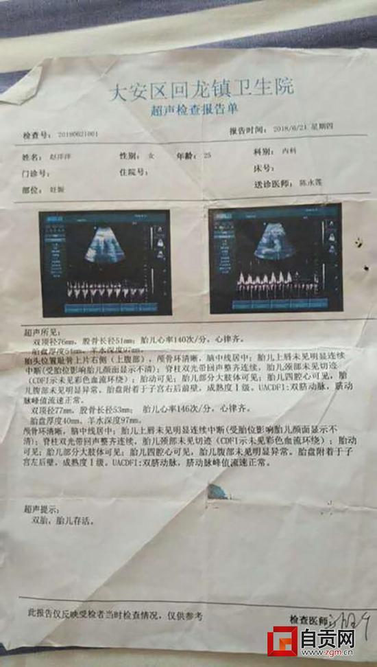 自贡女子产检显示双胞胎 生下来却只有一个