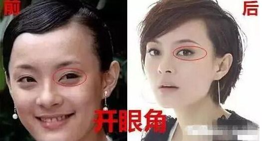孙俪自曝整过容开眼角垫下巴整容前后对比照曝光_中国网客户端
