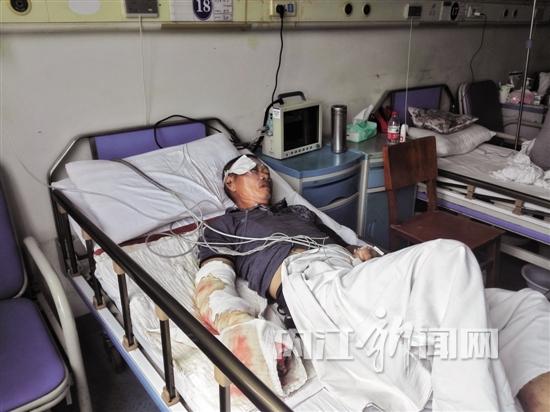 近日,市中区凌家镇乌鸡冲村村民叶云东在打农药时被蛇咬伤,因处理不恰当险些酿祸。