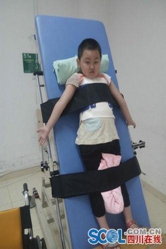 遂宁7岁女孩跌伤双下肢截瘫 50万医疗费愁坏家