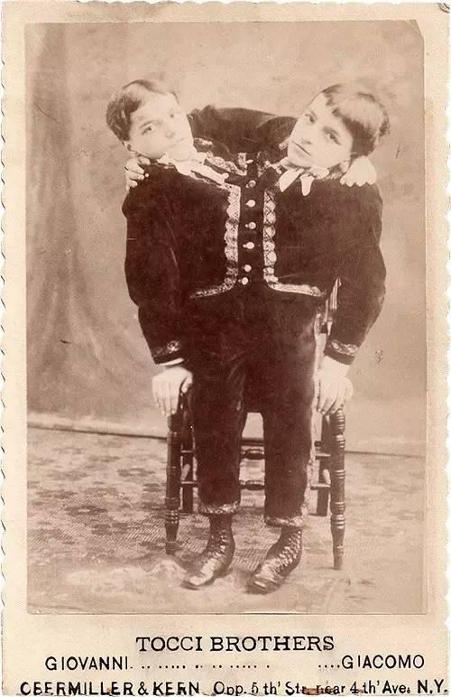 　　连体的Tocci兄弟，他们共享一个脊椎，但却有着完全相反的人格。左边的Giacomo行动缓慢，愚钝，右边的Giovani活泼并且机敏。