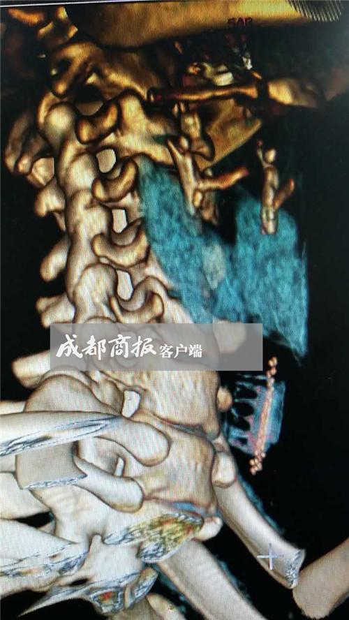 医院供图