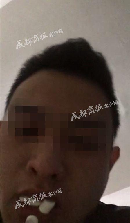吞百粒药片以死示爱