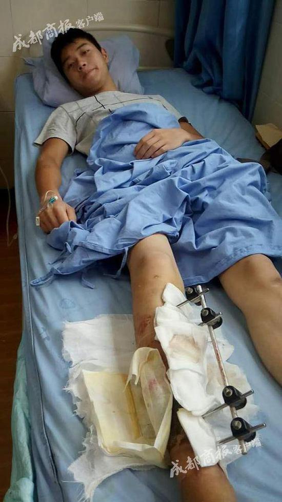 资阳男子车祸住院 其父亲借1.3万元手术费被烧光