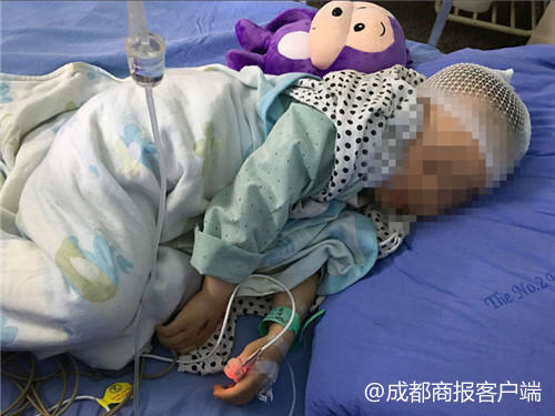 宜宾4岁男童被公园游乐场小火车碾伤 致头部骨