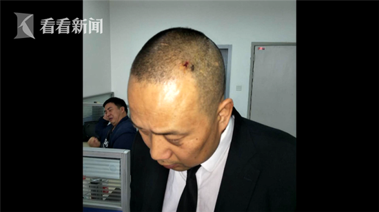 小偷超市偷盗咬伤保安
