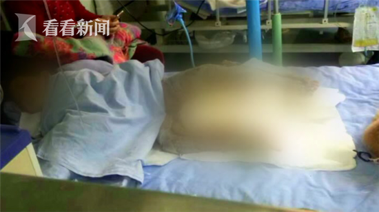 4岁女孩睡着时沙发起火