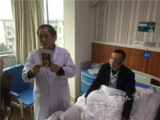 脸上小胎记未处理侵入眼球 成都男子长出罕见