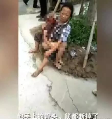 男童被緊急送醫,目前仍昏迷不醒