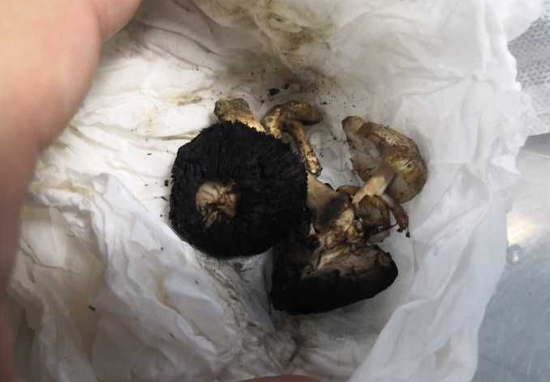 病重与延误治疗有关 狂躁是因中枢神经受损