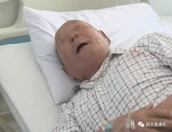　　患者王大爷也是误食了粽子里的枣核，吃饭一说话把核咽下去了。