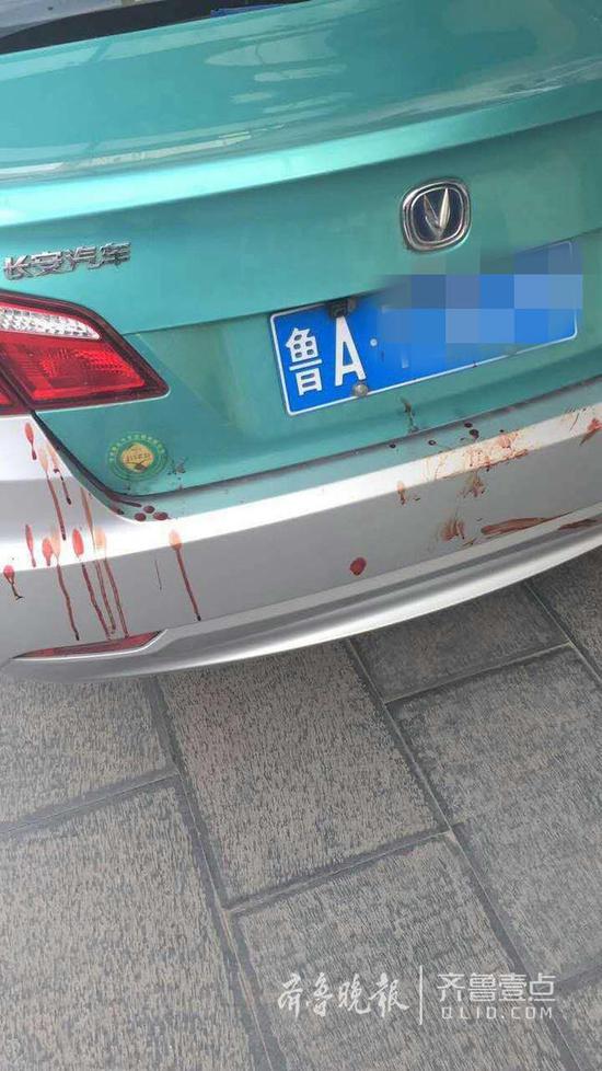 据朱先生称,事发后出租车司机就被送往市立三院抢救,现在仍在抢救室中。司机的家属也已赶到医院。