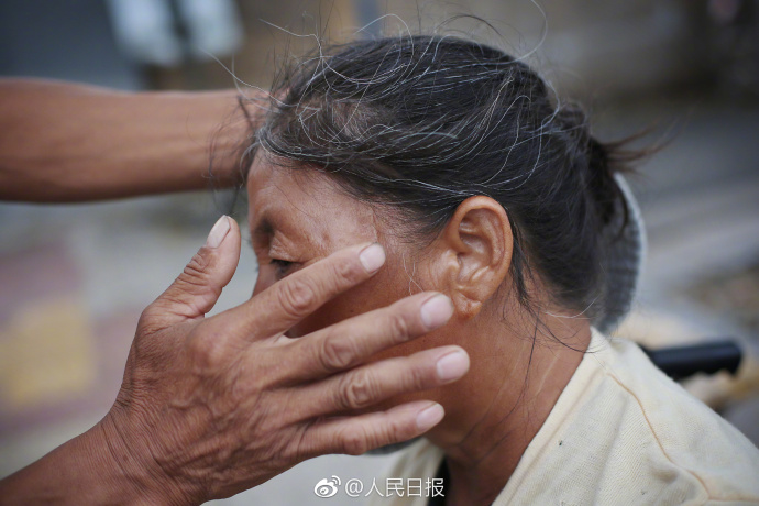 每天他都會(huì)給妻子按摩身體，防止肌肉萎縮。