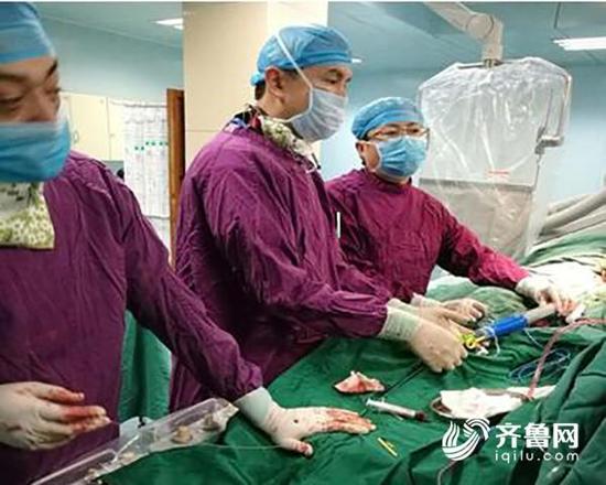 (努力培养当地人才,台上指导主动脉微创手术)