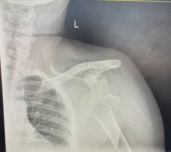 （复位前DR结果）