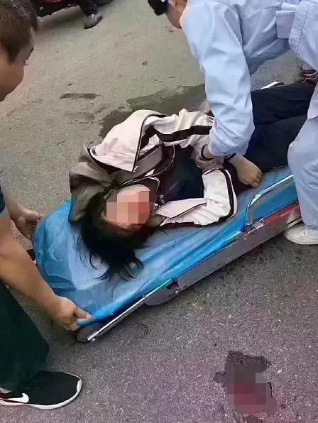 “女孩被撞,緊急尋找家長”
