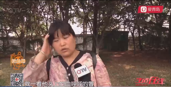 9歲的碩碩意外受傷,臉上和頭上加起來縫了20針,令父母心疼不已。