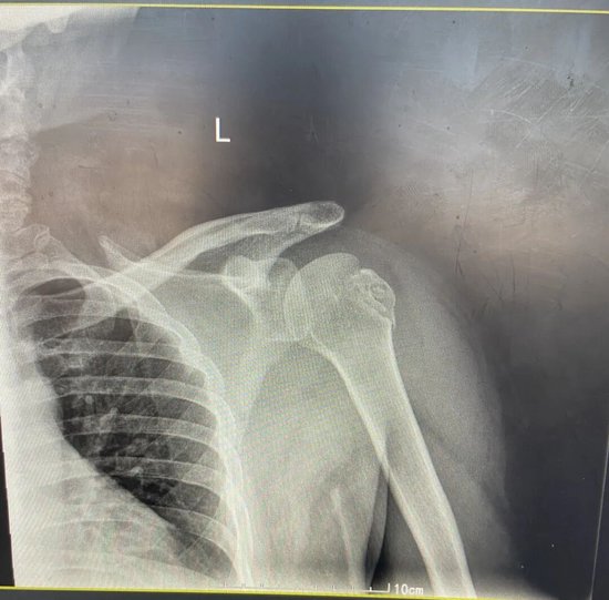 （复位后DR结果）