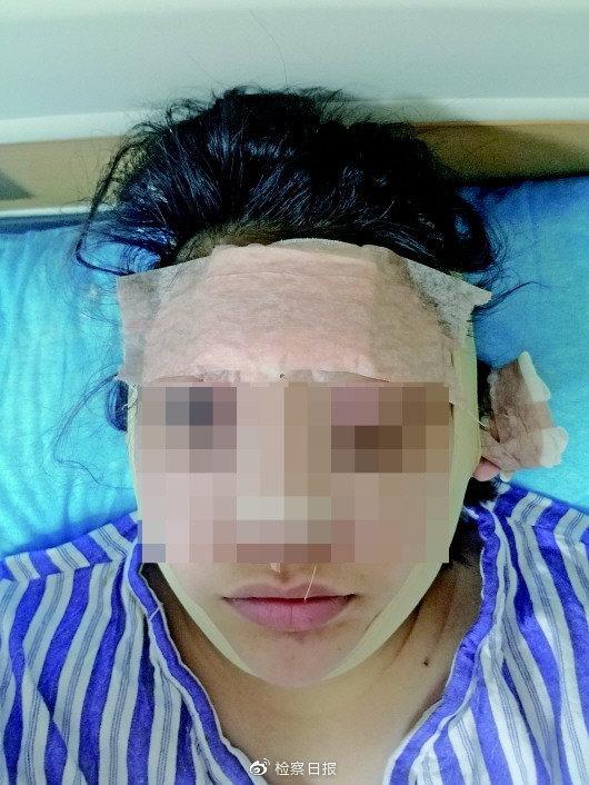 为了当主播,李华选择整容。 受访者供图