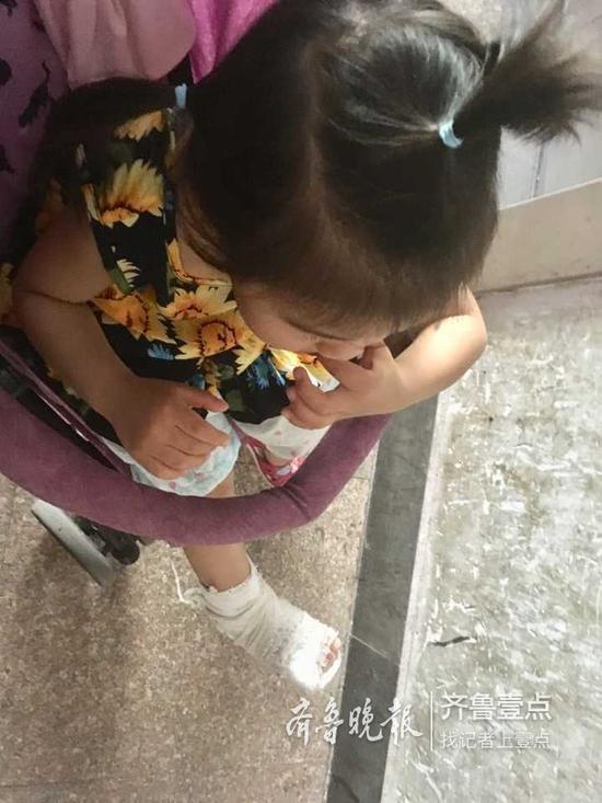 (壹粉供图 女童脚面骨折)