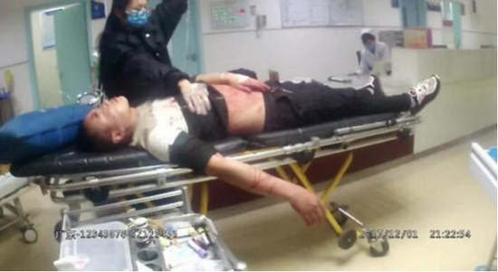 刘某在医院接受治疗 摄影/通讯员王丹刘某在医院接受治疗 摄影/通讯员王丹