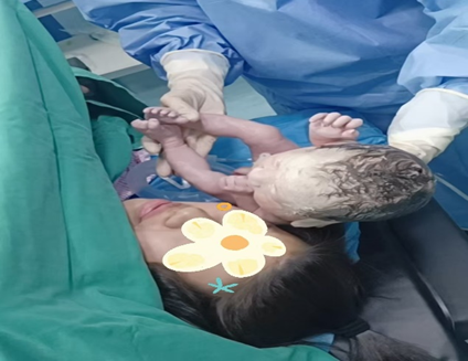 陵城区人民医院——“生命线”险变“夺命锁”，脐绕颈5周紧急获救！