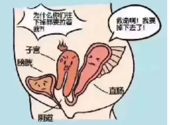 (图)松弛的盆底肌