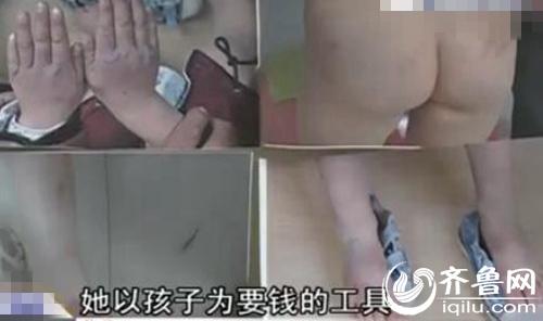 　孩子奶奶稱，兒媳婦曾經暴打孫子，孫子手上、屁股以及腿部很多傷痕。（視頻截圖）