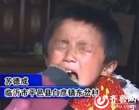 　臨沂市平邑縣的五歲男孩蘇德成得了一種怪病，每天咬手(視頻截圖)