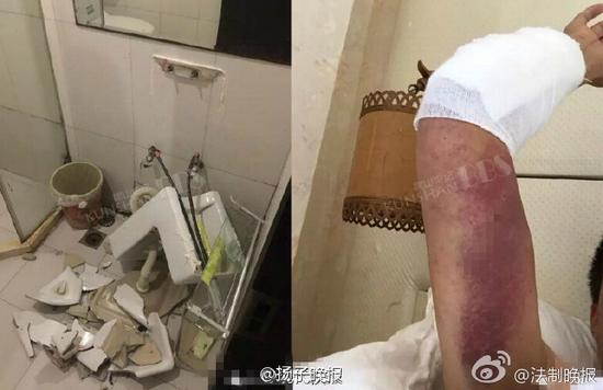 洗臉池碎了