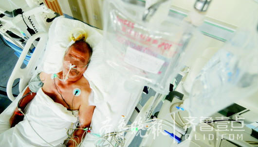 在菏泽市中医医院ICU病房里,今年67岁的环卫工耿大爷因中暑躺在病床上。　　本报记者邓兴宇摄