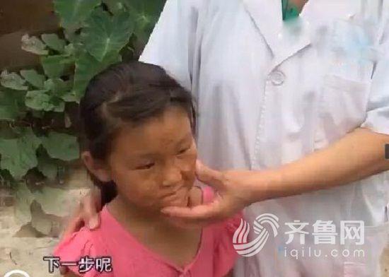 只因妈妈的失误小女孩的脸上留下了疤痕