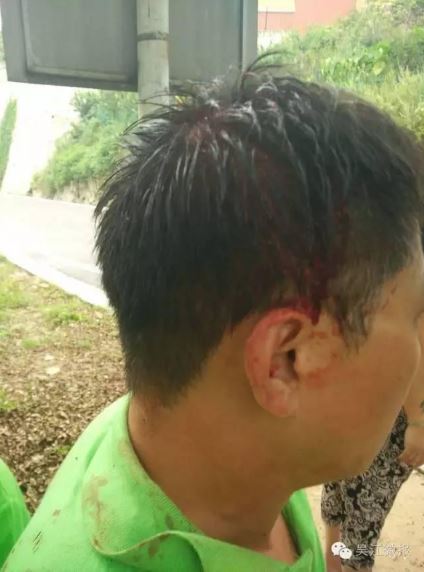 伤者头部流血。网帖爆料:一言不合,景区人员拳打脚踢