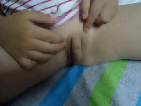 男童私處有一處明顯的傷。
