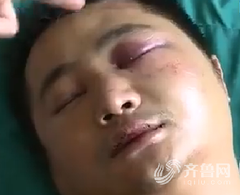 業(yè)主史大哥的兩個眼睛都腫了(視頻截圖)