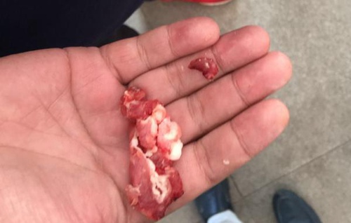 家長們拍攝到的在學(xué)校食堂廚房里發(fā)現(xiàn)的疑似“淋巴肉”。 英才實驗學(xué)校家長供圖