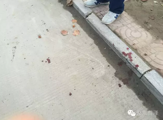 菏澤學生躲遠光燈車輛 頭部撞上大樹