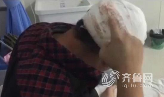 男子頭部被打后縫了12針