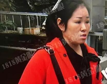 整形后的女子