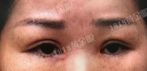 女子的眼睛