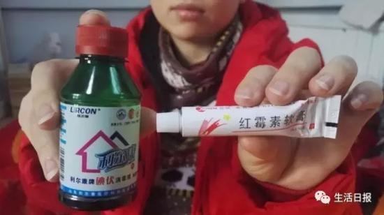 紗布遺留期間，劉芳用的碘伏和紅霉素藥膏。