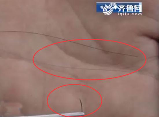 细如发丝的针和线