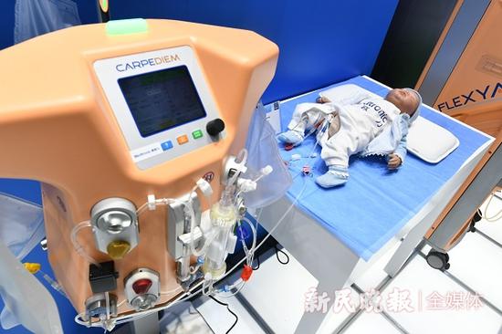 图说:婴儿血透仪器 新民晚报记者 孙中钦 摄