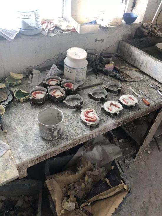 警方捣毁的假牙生产“黑窝点”