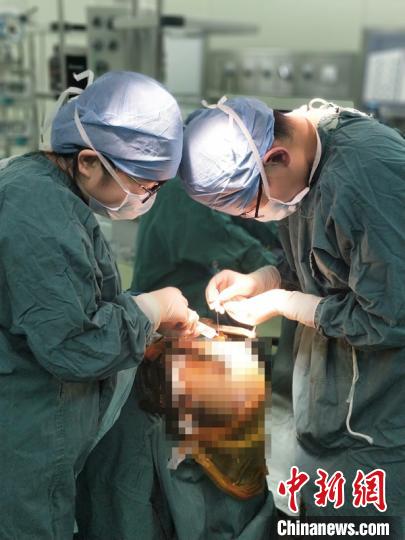 第二次手术中，专家们完成致痫区“裁剪式”完整切除。儿科医院供图

