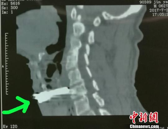 山西省有多少人口_山西一个管辖多达17个区县的地级市(3)