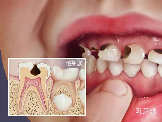 (图源:腾讯医典)