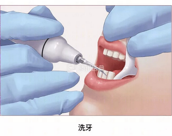 (图源:腾讯医典)