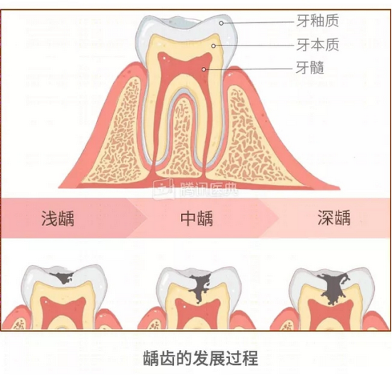 (图源:腾讯医典)